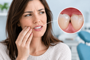 caries-interdental