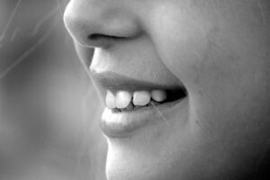 dientes-desgastados
