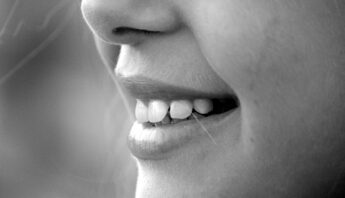 dientes-desgastados