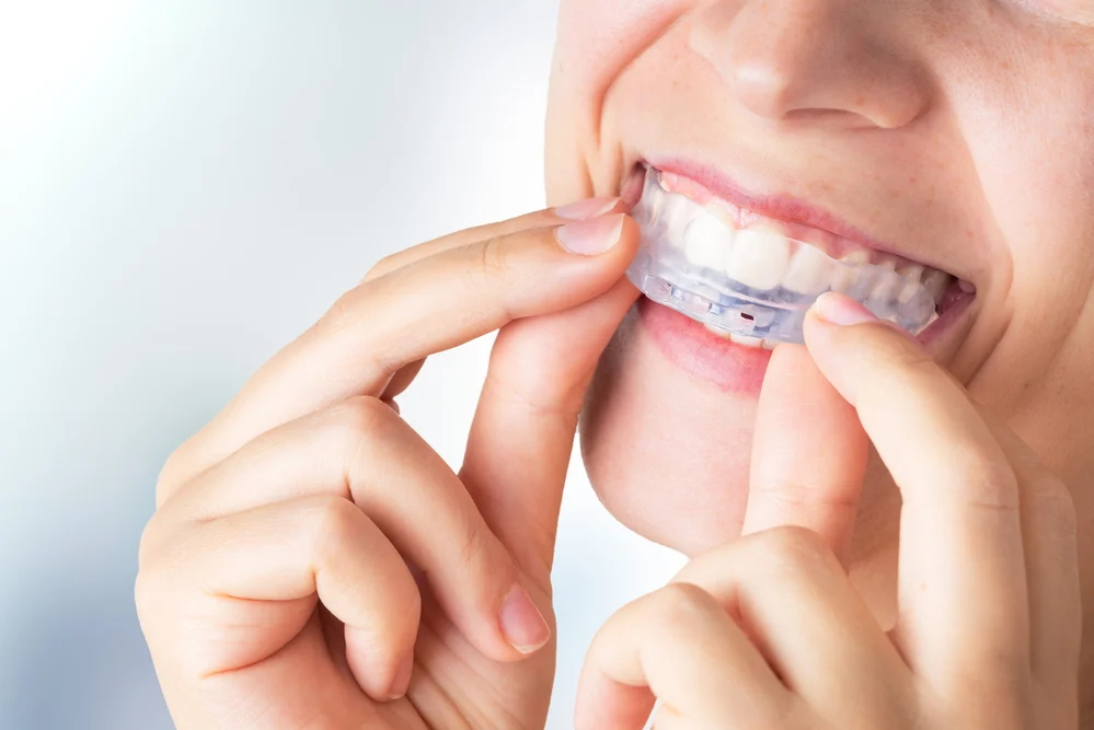 ferulas descarga bruxismo